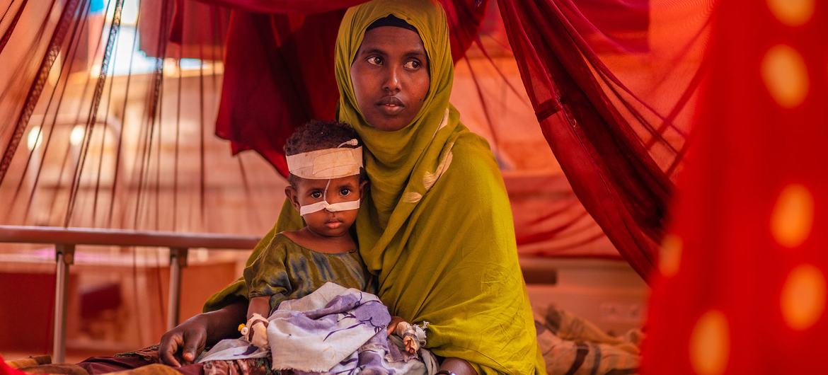 A child receives nutritional treatment at a UNICEF-supported hospital in the Somali region of Ethiopia.