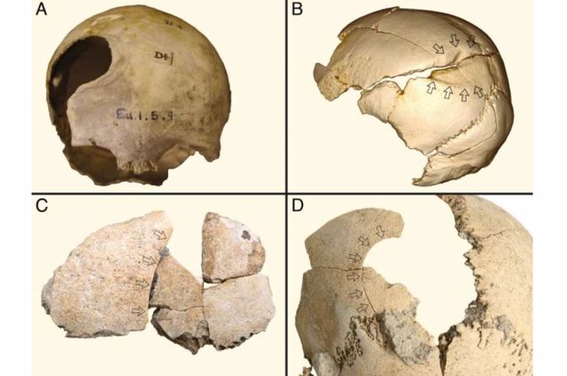 Examples of blunt force trauma to Neolithic skulls from northwestern Europe: (A) Belas Knap, England (unhealed);  (B) Schöneck-Kilianstädten, Germany (cured);  (C and D) Halberstadt, Germany (uncured).