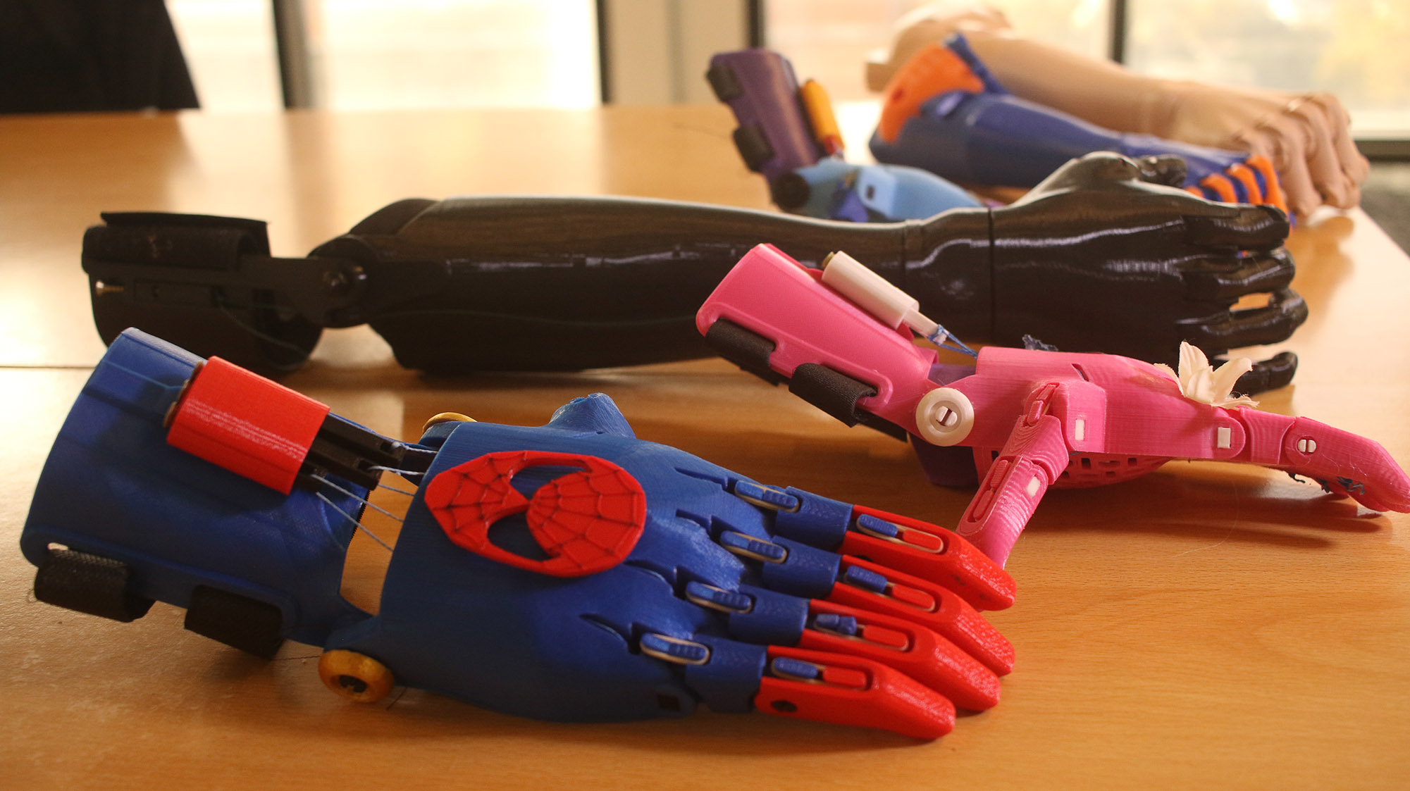 "It was a before and after": 3D printed prostheses are changing the lives of more than 100 amputees in Uruguay