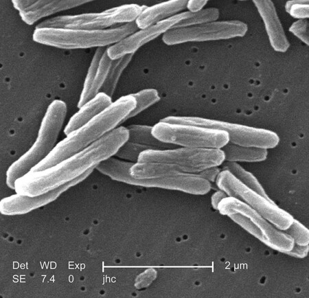 Mycobacterium Tuberculosis