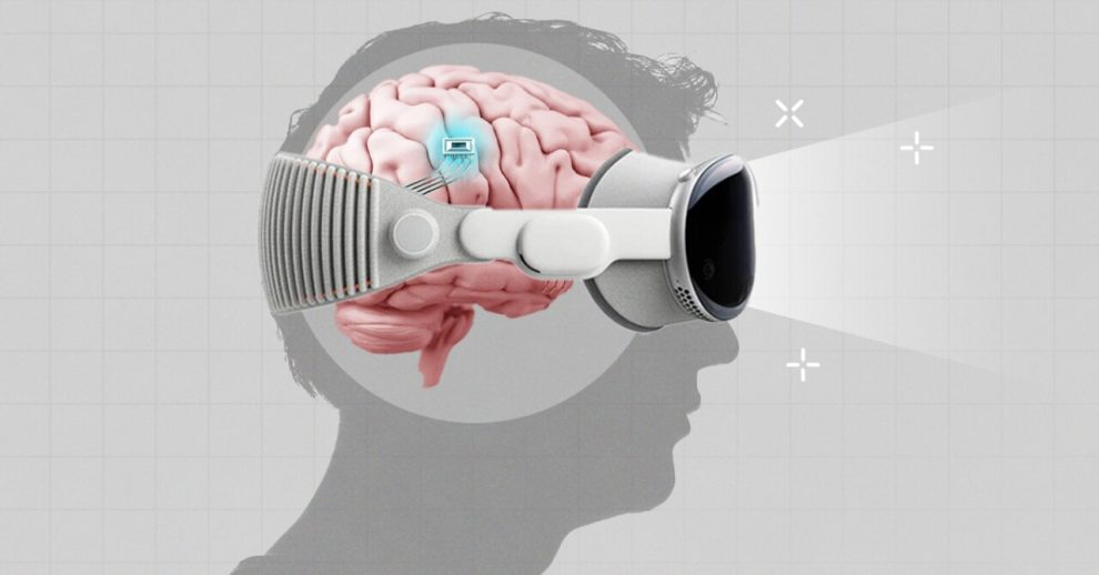 Synchron implants a brain chip to control Vision Pro with the mind