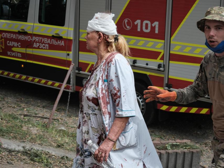 A nurse at a children's hospital in kyiv, with a head wound and blood on her clothes, tries to help after the Russian attack.