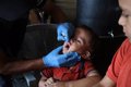 Gaza authorities say more than 72,600 children have been vaccinated against polio on the first day of the campaign