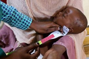 UNICEF: Tens of thousands of children in Sudan are at risk of starvation