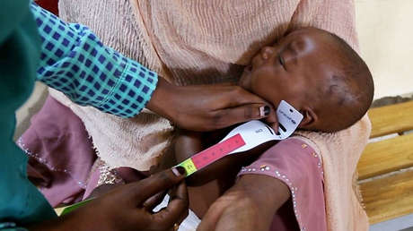 UNICEF: Tens of thousands of children in Sudan are at risk of starvation