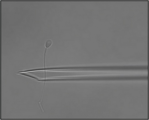 This is the probability of finding sperm in a testicular biopsy