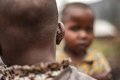 Mpox affects children in Africa, although the lessons learned from COVID-19 slow its expansion