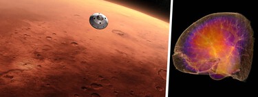 Largest study in mice raises doubts about trips to Mars: space shrinks kidneys