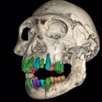 3D reconstruction of the subadult early Homo fossil skull from the Dmanisi site in Georgia.