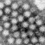 What is norovirus and why is it of concern this season in the US?