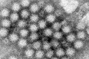 What is norovirus and why is it of concern this season in the US?