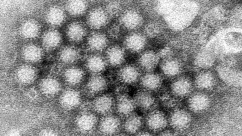 What is norovirus and why is it of concern this season in the US?