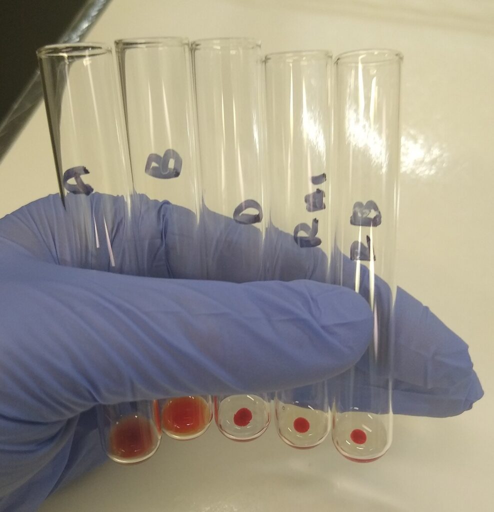 BBC presenter Maryam Moshiri reveals incurable blood cancer